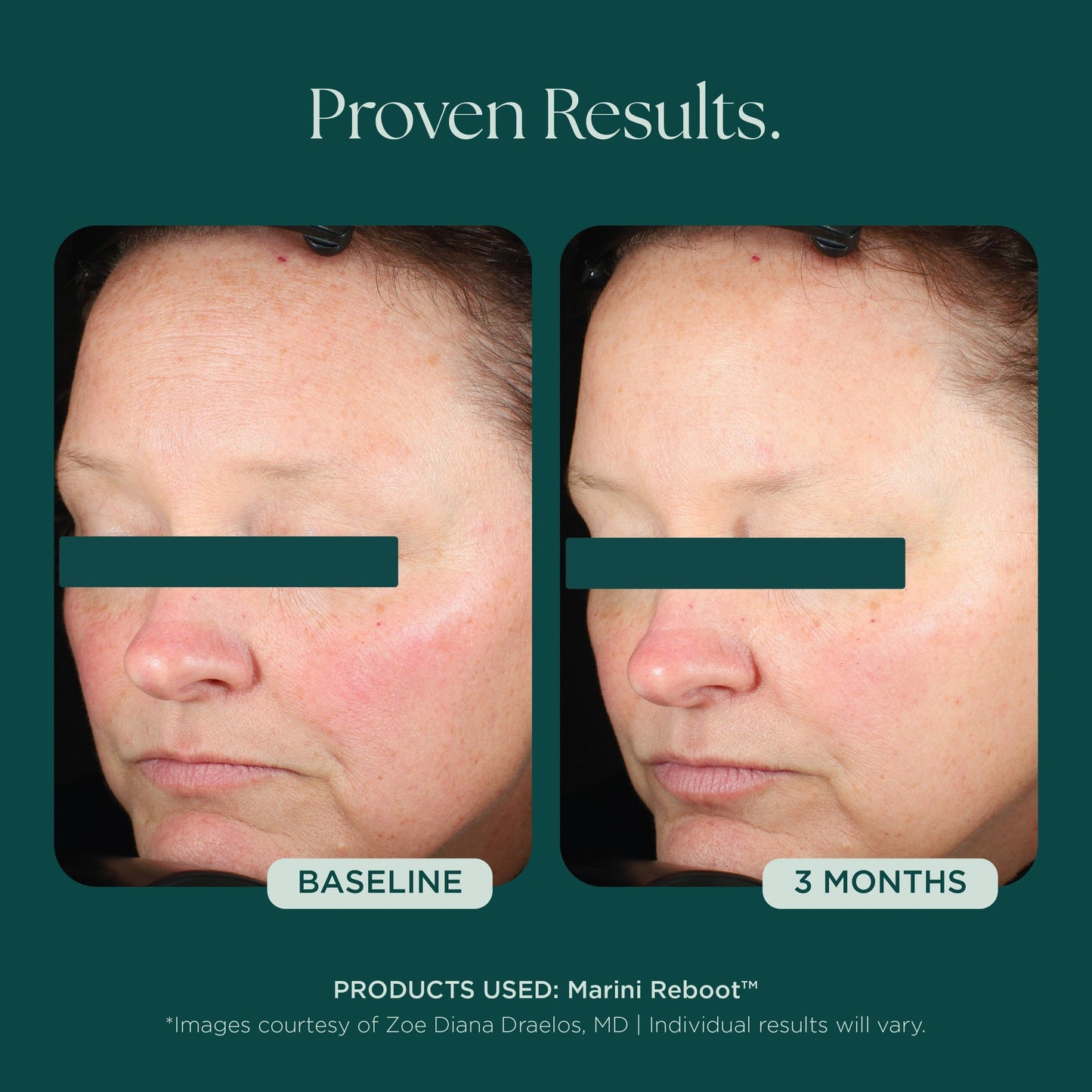 Marini Reboot PDRN Face Serum